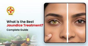 Jaundice treatment through Ayurveda at Jeena Sikho HiiMs