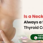 Is a Neck Lump Always a Sign of Thyroid Cancer?