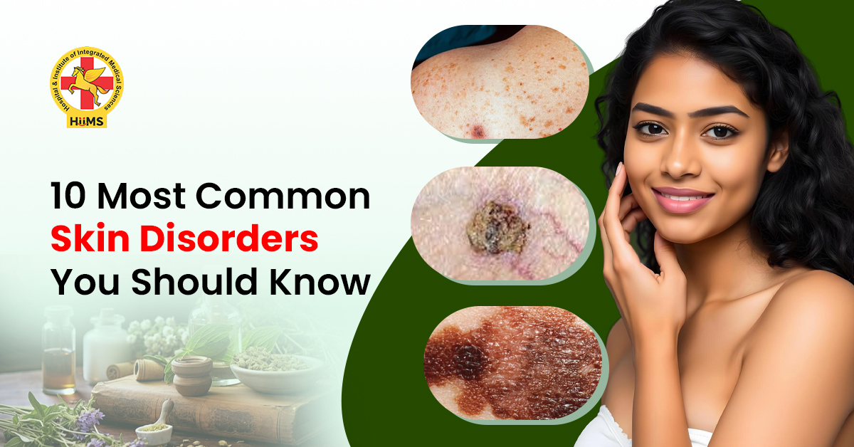 10 Most Common Skin Disorders You Should Know