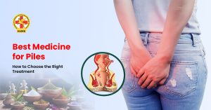 Best Medicine for Piles How to Choose the Right Treatment