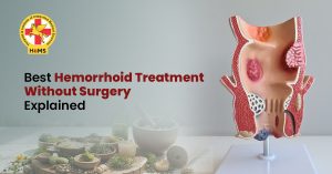 Best Hemorrhoid Treatment Without Surgery Explained