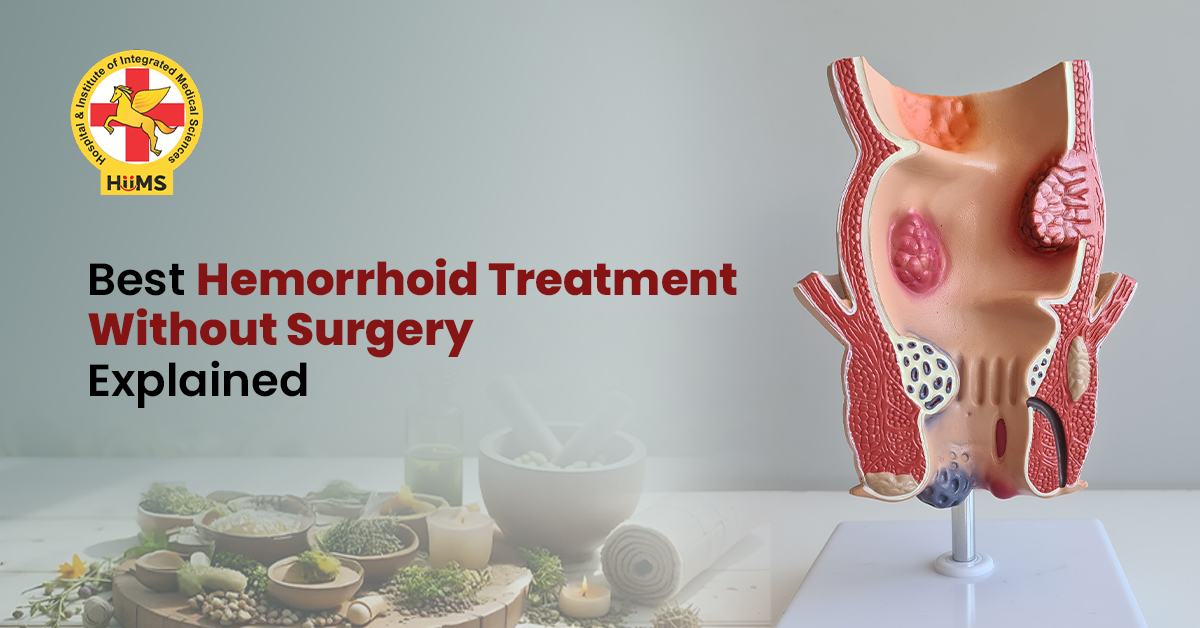 Best Hemorrhoid Treatment Without Surgery Explained