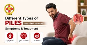 Different Types of Piles and Their Grades Symptoms & Treatment