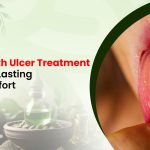 Mouth Ulcer Treatment for Long-Lasting