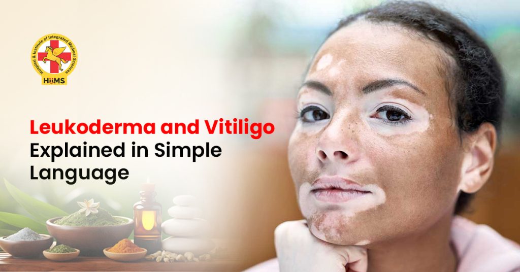 Leukoderma and Vitiligo Explained in Simple Language