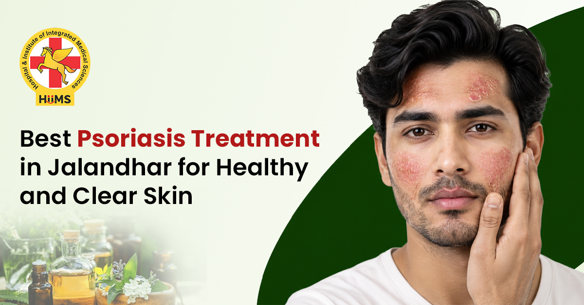 Best Psoriasis Treatment in Jalandhar