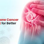 Effective Bone Cancer Treatment for Better Recovery