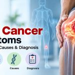 Bone Cancer Symptoms: Types, Signs, Causes & Diagnosis