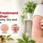 Eczema Treatment in Jalandhar: Managing Itchy, Dry and Irritated Skin