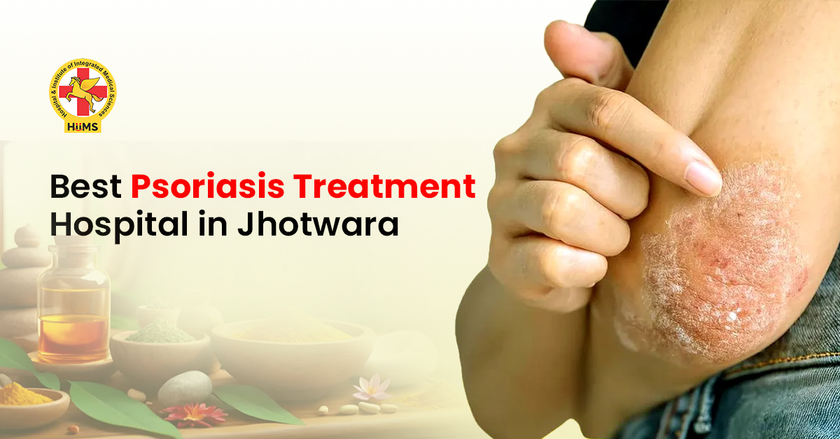 Best Psoriasis treatment Hospital in jhotwara