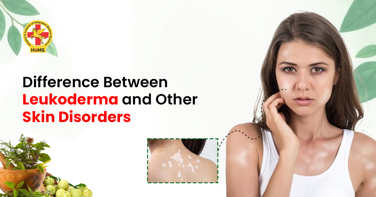 Difference Between Leukoderma and Other Skin Disorders