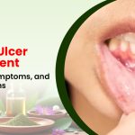 Mouth Ulcer Treatment