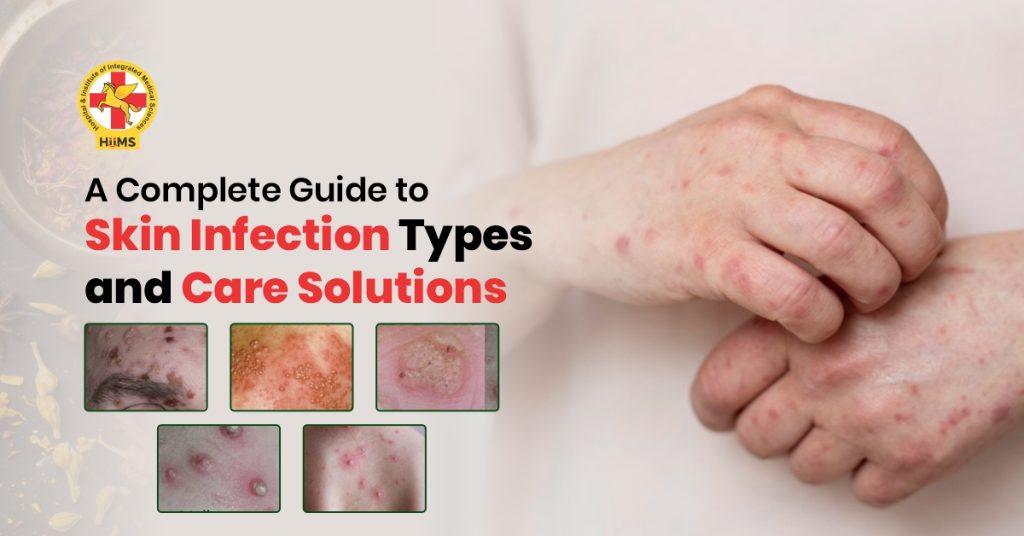 Skin Infection Types