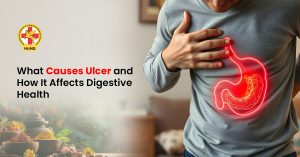 Causes Ulcer