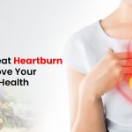 Heartburn Treatment