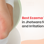 Best Eczema Treatment in Jhotwara for Healthy and Irritation-Free Skin