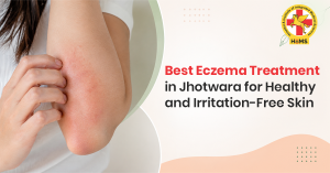 Best Eczema Treatment in Jhotwara