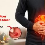 Stomach Ulcer and Gastric Ulcer Treatment in New Noida