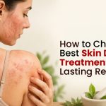 How to Choose the Best Skin Disease Treatment for Lasting Relief