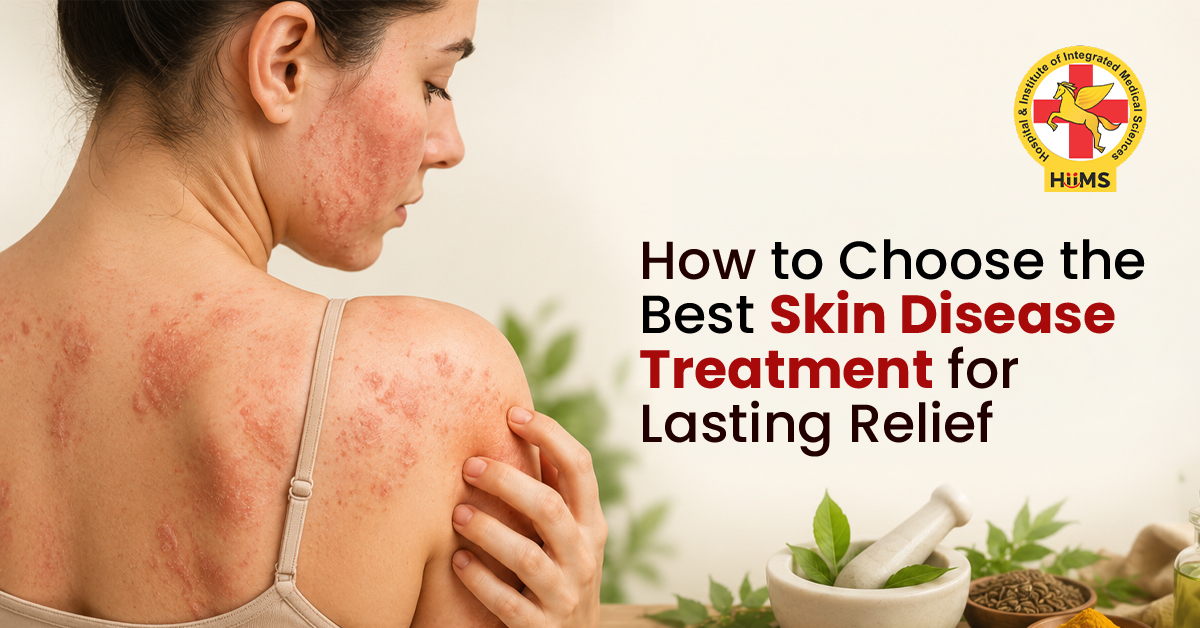 Best Skin Disease Treatment