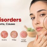 Skin Disorders: Types, Symptoms, Causes & Treatment
