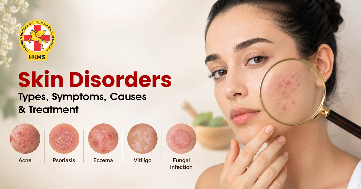 Skin Disorders Types, Symptoms, Causes & Treatment