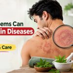 What Problems Can Fungal Skin Diseases Cause? Symptoms & Care
