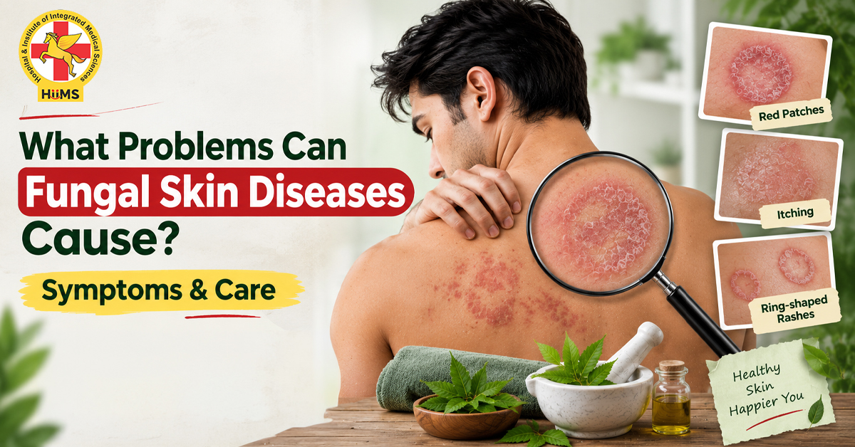 What Problems Can Fungal Skin Diseases Cause Symptoms & Care_
