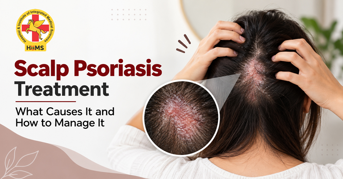 Scalp Psoriasis Treatment- What Causes It and How to Manage It