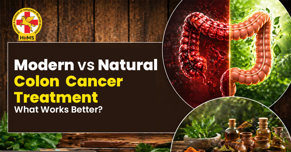 Modern vs Natural Colon Cancer Treatment What Works Better