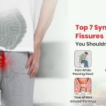 Top 7 Symptoms of Fissures You Shouldn’t Ignore