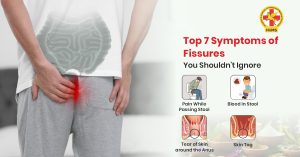 Top 7 Symptoms of Fissures You Shouldn't Ignore