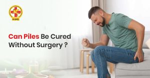 Can Piles Be Cured Without Surgery