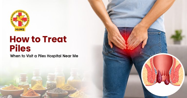 How to Treat Piles When to Visit a Piles Hospital Near Me