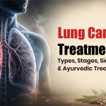 Lung Cancer Treatment: Types, Stages & Ayurvedic Treatment (2026)