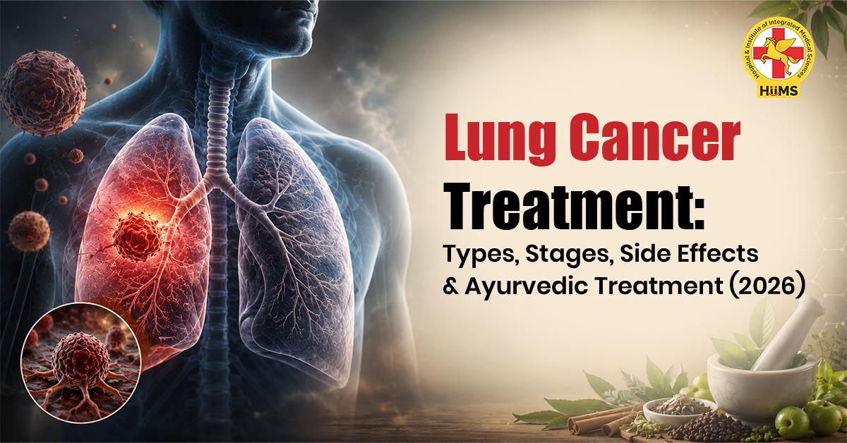 Lung-Cancer-Treatment