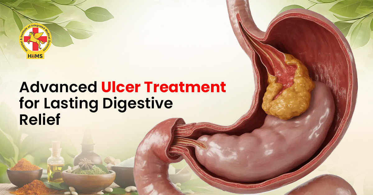 Advanced Ulcer Treatment