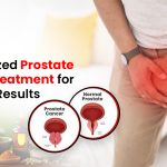 Personalized Prostate Cancer Treatment