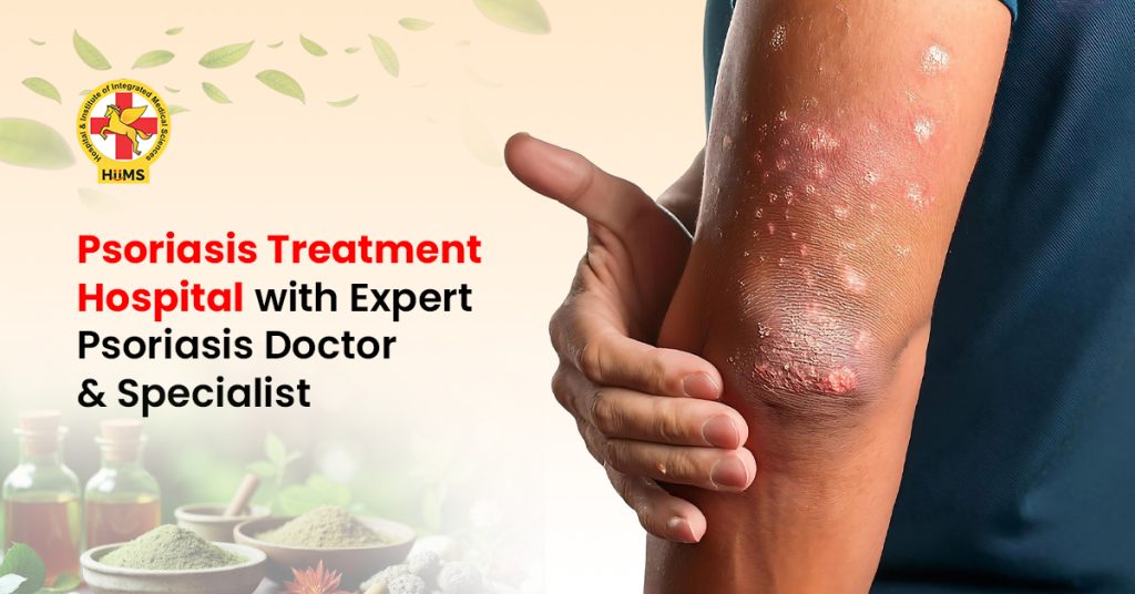 Psoriasis Treatment Hospital