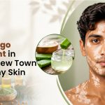 Best Vitiligo Treatment in Kolkata New Town for Healthy Skin