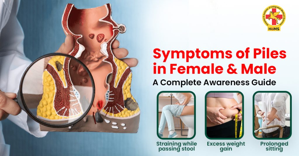 piles symptoms