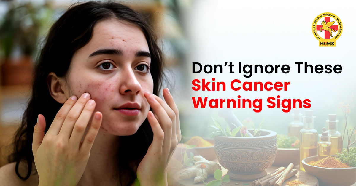 Early Signs of Skin Cancer