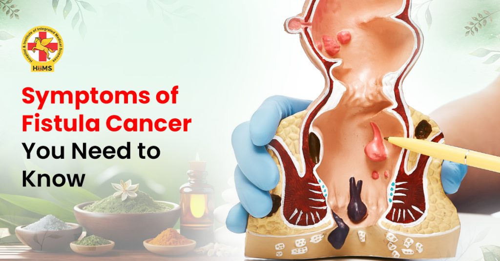 fistula cancer symptoms