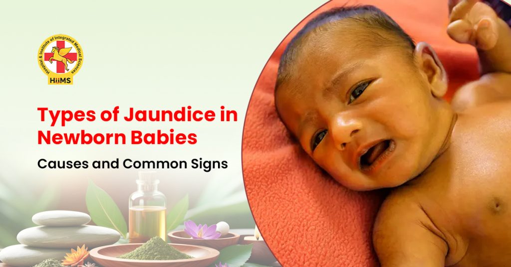 Types of Jaundice in Newborn Babies Causes and Common Signs