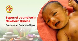 Types of Jaundice in Newborn Babies Causes and Common Signs