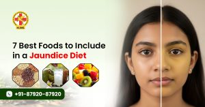 Jaundice Diet