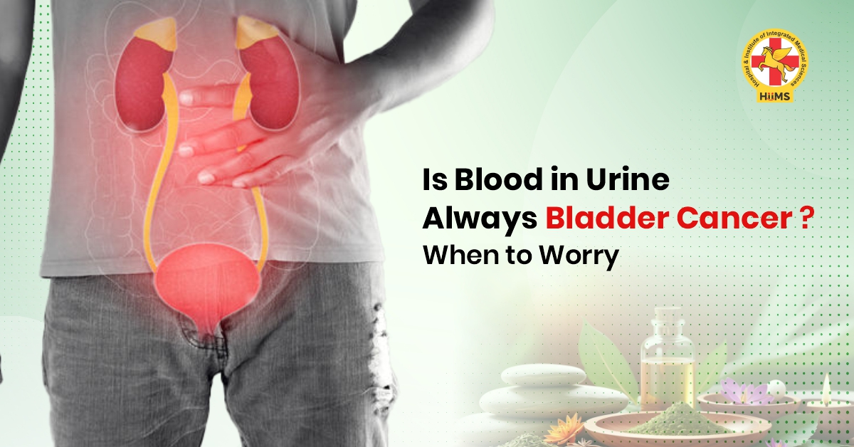 Is Blood in Urine Always Bladder Cancer