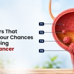 Risk Factors That Increase Your Chances of Developing Bladder Cancer