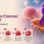 How Does Cancer Develop? The Step-by-Step Process of Cancer Formation