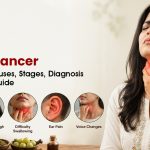 Throat Cancer: Symptoms, Causes, Stages, Diagnosis & Treatment Guide